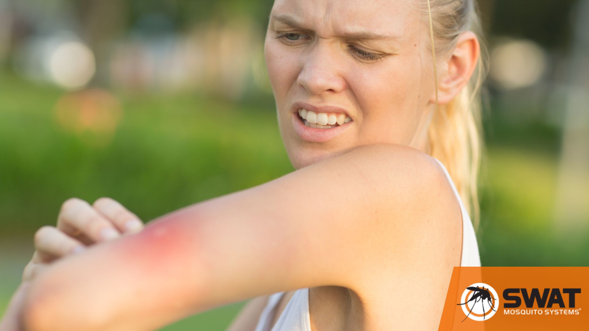 Itchy Mosquito Bites? Try These Natural Solutions for Relief