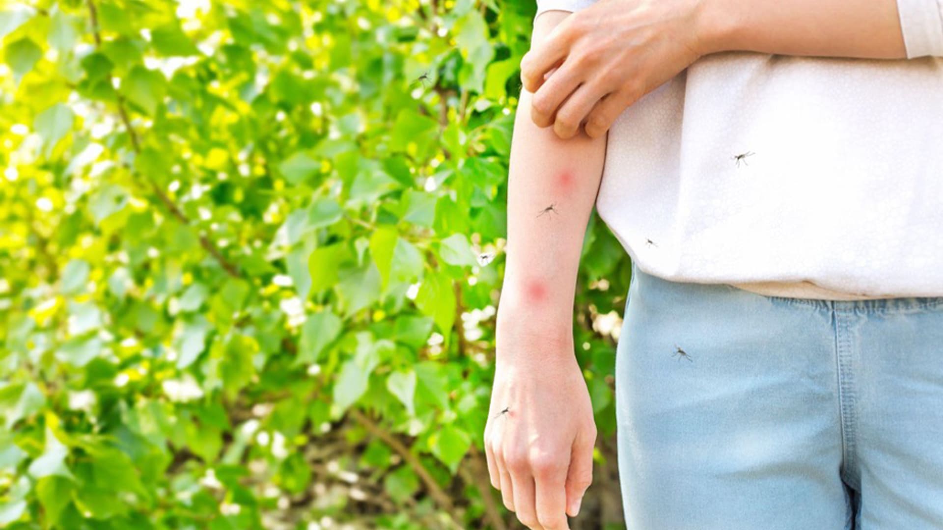 Why Are Mosquito Bites So Itchy?
