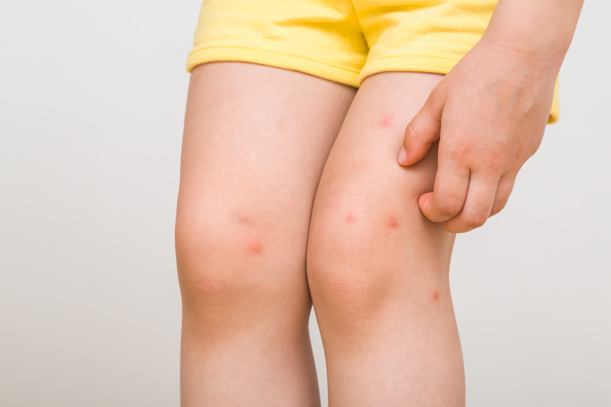 Fogging vs. Misting: Which Mosquito Control Solution Is Best for Your Florida Home?