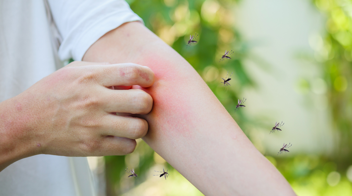 Why August Is Peak Mosquito Month in Florida (And How to Fight Back – SWAT Guide)